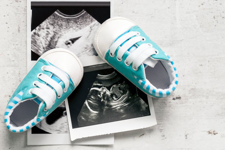 Blue booties next to baby photos with ultrasound at 4 and 20 weeks of pregnancy. The concept of awaiting baby boy, pregnancy. A son. Selective focusの写真素材