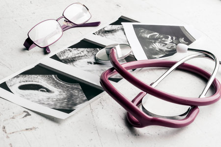Phonendoscope vs stethoscope and glasses lie on ultrasound images of the embryo at 4 and 20 weeks of...