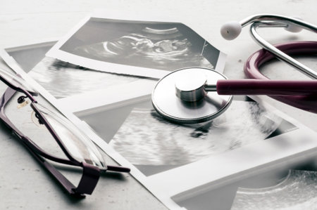Phonendoscope vs stethoscope and glasses lie on ultrasound images of the embryo at 4 and 20 weeks of...