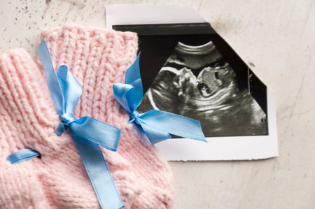 Knitted pink socks for the child DIY, lying on the picture ultrasound. Waiting for the child,...
