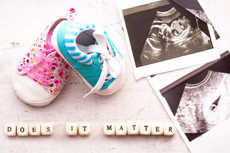 Blue and pink baby booties with picture of ultrasound for 20 weeks and 4 weeks on a light background. Inscription does it matterの写真素材