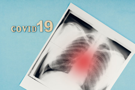 Coronavirus, covid-19. The inscription covid-19 and x-ray snapshot of the lungs on a blue background. Self-isolation and quarantine, pneumonia. Diagnosis of lung diseasesの写真素材