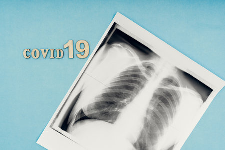 Coronavirus, covid-19. The inscription covid-19 and x-ray snapshot of the lungs on a blue background. Self-isolation and quarantine, pneumonia. Diagnosis of lung diseases.の写真素材