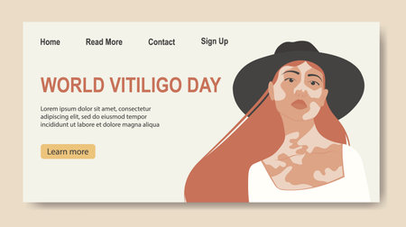 Young white girl illustration with vitiligo banner. World Vitiligo Day. Red hair cartoon woman.のイラスト素材