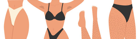 Woman unshaved hairy body illustration set. Body positive, normalize female body hair, skin care. Vector illustration in cartoon style. Isolated white backgroundのイラスト素材