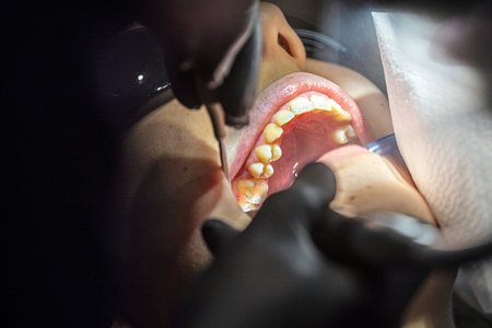 dentist uses a special instrument to restore a patient's tooth with a mirror. Dental care and care