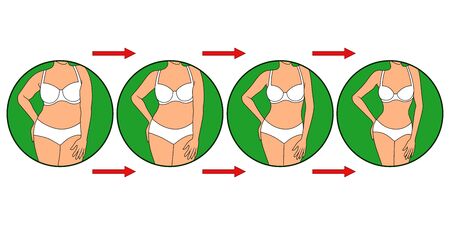 Body of woman on the way to lose weight in underwear in green circle, four stages isolated over white illustrationのイラスト素材