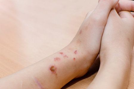 Scars from cuts and burns on the arm.