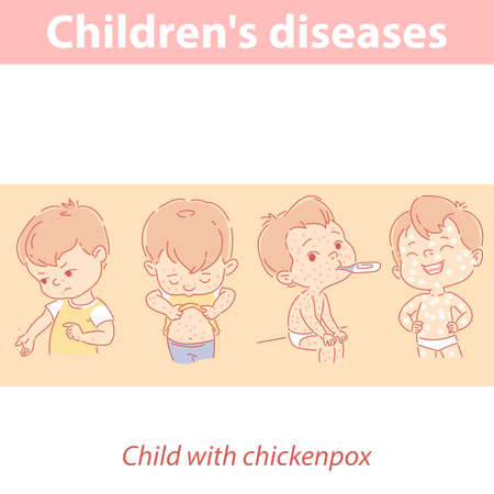 Chickenpox Rash Stages Vector of Stages of chickenpox and - ID:1-150709005 - Royalty Free ...