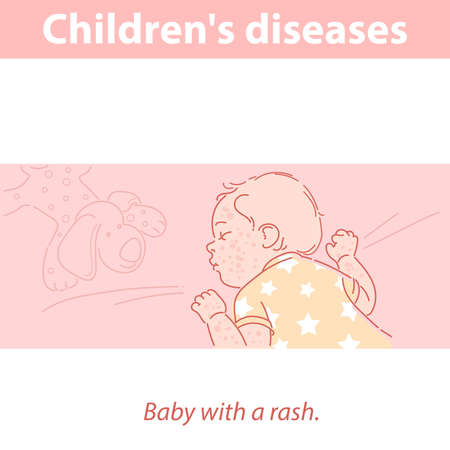 Little baby with rash on face and body.のイラスト素材