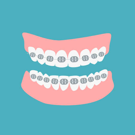 Denture icon gums with teeth and braces isolated on green background. Alignment teeth process. Dental prostheses. Orthodontic healthcare concept. Vector flat cartoon illustration.のイラスト素材
