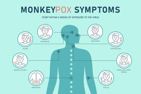 Monkeypox virus symptoms infographics with people silhouette icons isolated on white background. Vector flat illustration for medical concept. Design for banner, poster, flyer.のイラスト素材
