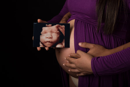 Pregnant woman holding ultrasound image of her baby on black backgroundの写真素材