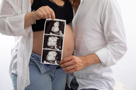 Pregnant couple holding ultrasound photo of their baby in the studioの写真素材
