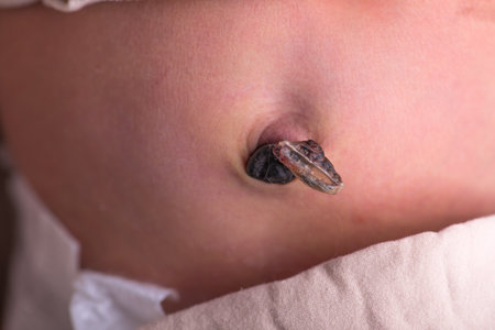 Close-up of a newborn baby's ear with a hearing aidの写真素材