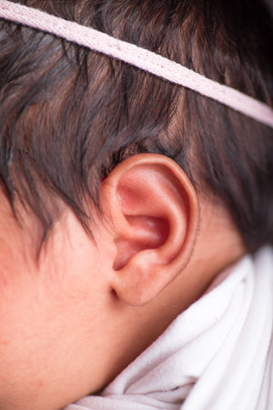 Close up of the ear of a baby boy wearing a hearing aid