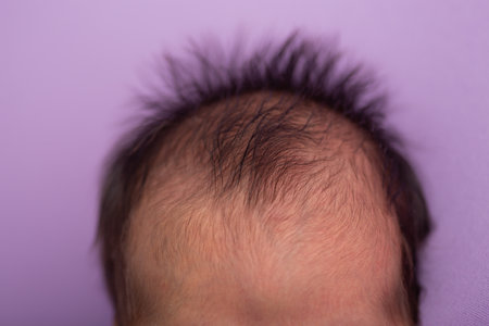 Newborn baby with hair loss on a purple background, close-upの写真素材
