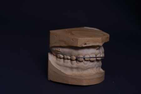 Dental Stone Study Models