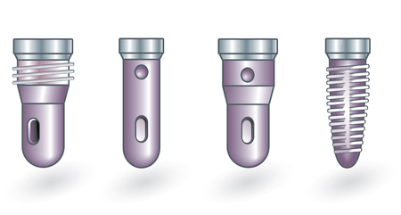 Tooth implantsのイラスト素材