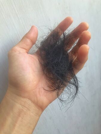 Hair loss problem, Hair fall in handの写真素材
