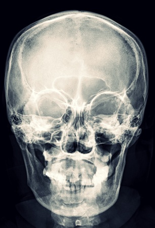 X-ray Skullの写真素材