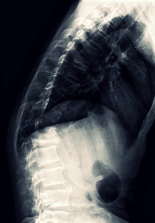 X-ray T-L Spineの写真素材