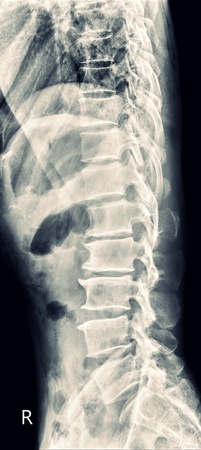 X-ray T-L Spineの写真素材