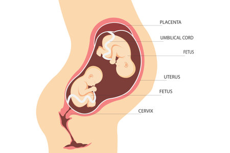 double pregnancy. Anatomy of the uterus with twin fetuses. Placement of dizygotic twins. flat illustration.のイラスト素材