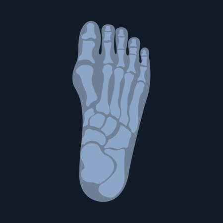 Medical radiology. Upper radiograph of a human foot or limb. X-ray or radiographic image of the bones of the metatarsus and toes, viewed from above.のイラスト素材