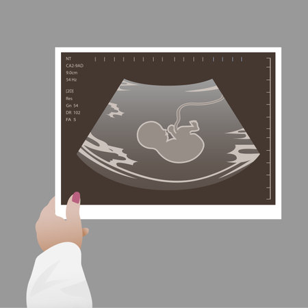 Ultrasound of a child. An ultrasound scan of the fetus of a pregnant woman. Medical diagnosis...
