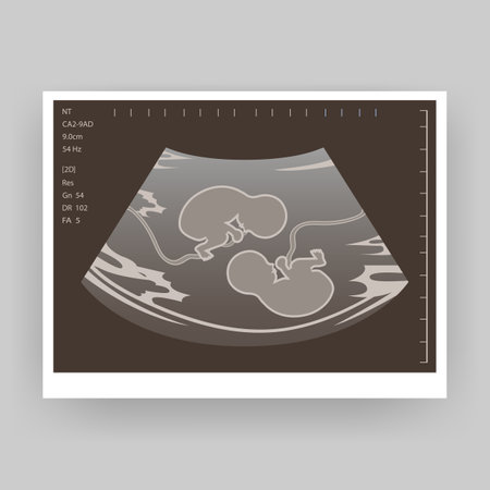 Ultrasound of a twin in the womb. Vector illustration in greyscale. An ultrasound image of a baby. Medicine and health of the fetus of twins. Realistic Embryo Sonogramのイラスト素材