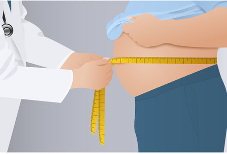 Doctor measuring obesity male body fat waist. Obesity and weight loss.のイラスト素材