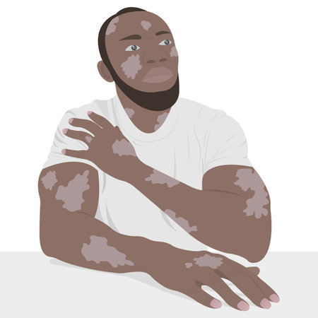 A young African American with vitiligo skin. Beauty diversity concept, positive body, self-acceptance, chronic skin disease awareness, illustrationのイラスト素材