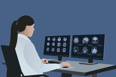 A radiologist analyzes the results of a patient's brain MRI on a computer monitor. Diagnosis of brain diseases in a doctor examining magnetic resonance imaging (MRI) Diagnosis of neurodegenerative disease in a patientのイラスト素材