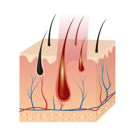 Laser Hair Removal Procedure After Exposure To Laser Light. Infographics Of Hair Follicle Influenceのイラスト素材