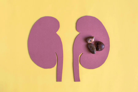 Abstract image of kidney disease and stones in them in close-up on a light background. Image of kidney stonesの写真素材