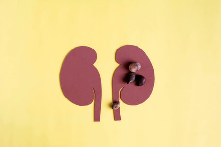Schematic image of kidneys and stones in them in close-up on a light backgroundの写真素材