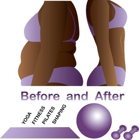 Woman's body before and after fitness,yoga. Cellulite versus smooth skin. Cellulite, Fat on belly.のイラスト素材