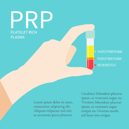 PRP poster with place for text. Hand holding a test tube filled with blood for PRP procedure. Laboratory centrifuge test tube with blood plasma.のイラスト素材
