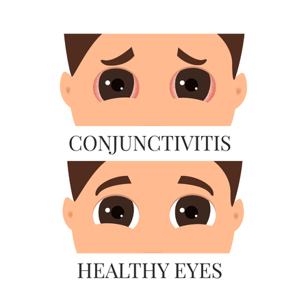 Man with conjunctivitisのイラスト素材