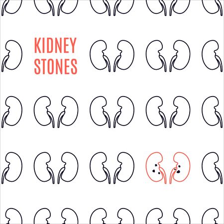 Kidney stone disease awareness poster made in linear style on white background. Renal stones disorder. Healthy urinary system medical concept. Human body organ anatomy icon. Vector illustration.のイラスト素材