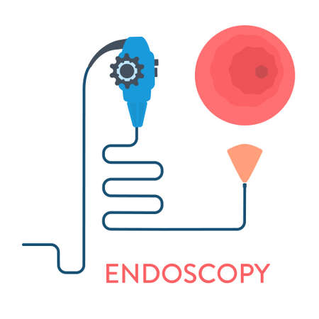 Endoscopy procedure equipment for disease diagnostics. Body organs examination with endoscope...