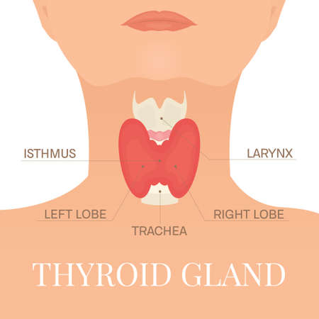 Thyroid gland in a silhouette of a womanのイラスト素材