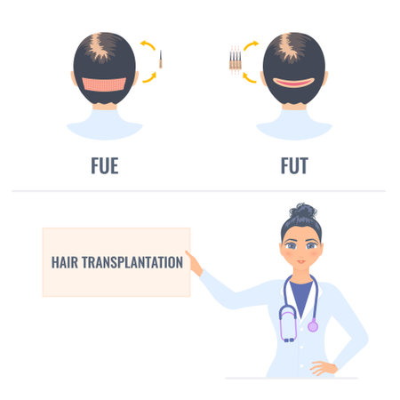 Hair transplantation placard in hands of a woman doctor. FUT and FUE female alopecia treatment infographics. Follicular unit extraction vs follicular unit transplantation. Medical vector illustration.のイラスト素材
