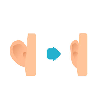 Cosmetic facial plastic ear surgery. Before and after otoplasty surgical correction procedure. Pinnaplasty ear pinning reshaping design template. Medical vector illustration.のイラスト素材