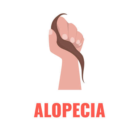Hand holding a damaged lock of hair. Hair shedding and thinning. Excessive hair fall problem. Alopecia symptom concept. Vector illustration.のイラスト素材
