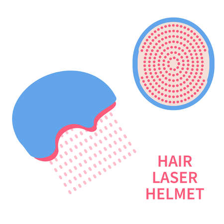 Laser hair growth helmet device. Red light therapy cap for hair restoration in androgenetic alopecia. Medical concept. Vector illustration.のイラスト素材