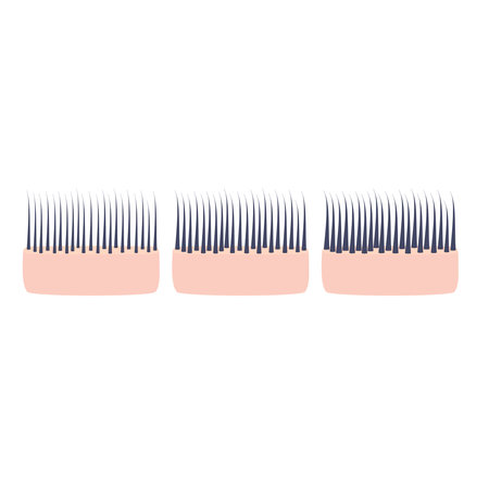Hair thickness types classification set. Skin cross-section with fine, normal, thick strands in diameter. Anatomical structure linear scheme. Outline vector illustration.のイラスト素材