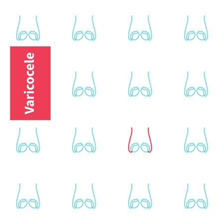 Varicocele disease awareness. Scrotum veins enlargement. Testes pattern. Testicles anatomy diagram. Male reproductive system disease. Medical concept. Vector illustration.のイラスト素材