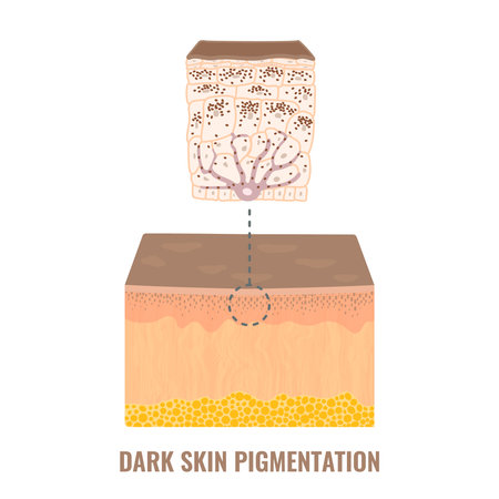 Melanin content and distribution in dark skin phototype. Pigmentation mechanism infographic diagram. Epidermis cross-section in closeup. Vector illustration.のイラスト素材